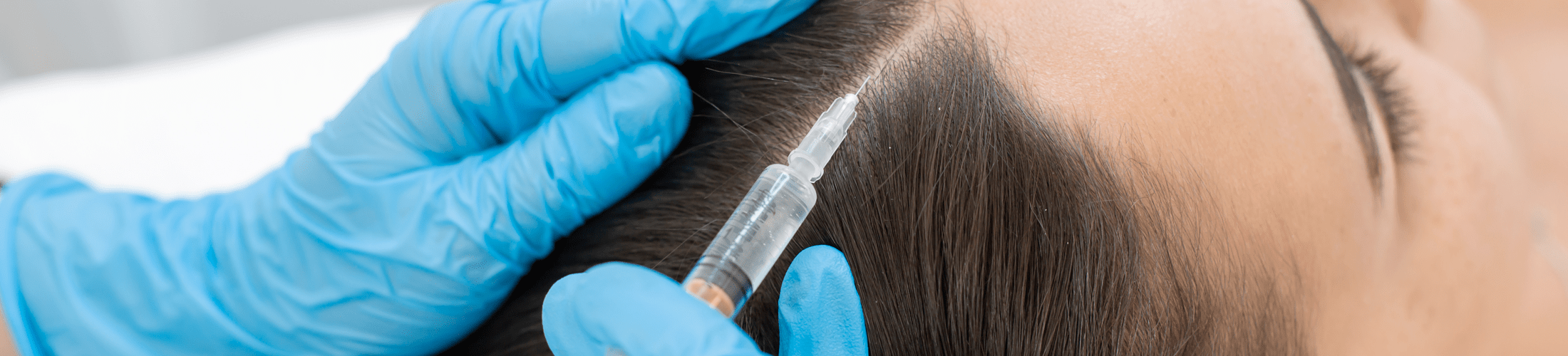 Mesohair gegen Haarausfall